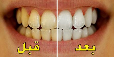 طرق منزلية لتبييض الأسنان - تدوينة الإخباري