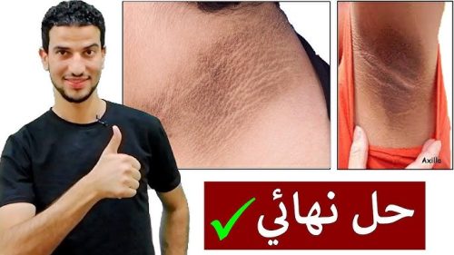 أقوي وصفة تبييض الجسم والمناطق الغامقة وتحت الابطين القضاء علي السواد والبقع والتصبغات 66 تبييض الجسم